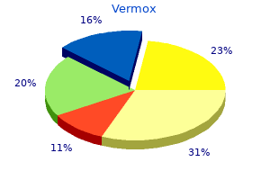 purchase 100 mg vermox free shipping